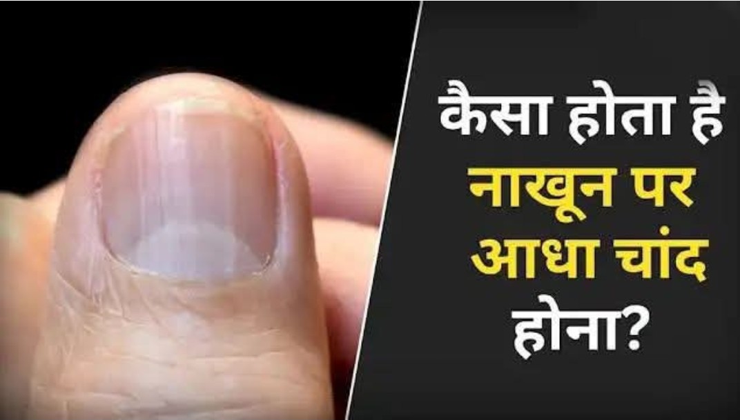 बड़ी खबर : कैसा होता है नाखून पर आधा चांद होना? हर उंगली पर होता है इसका अलग अर्थ। आखिर क्या और क्यों ? Tap कर जाने